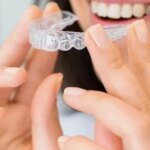 Aparatul-dentar-Invisalign-TOT-ce-trebuie-sa-stii.jpg