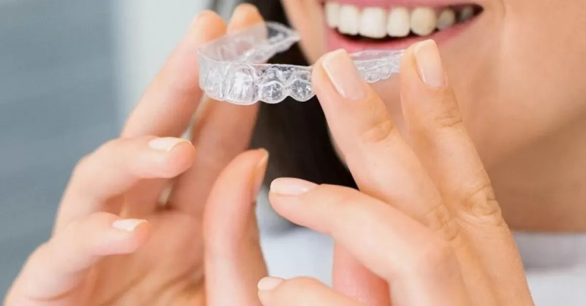 Aparatul-dentar-Invisalign-TOT-ce-trebuie-sa-stii.jpg