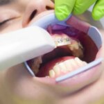 Cum-iti-dai-seama-ca-piticul-are-nevoie-de-aparat-dentar.jpg
