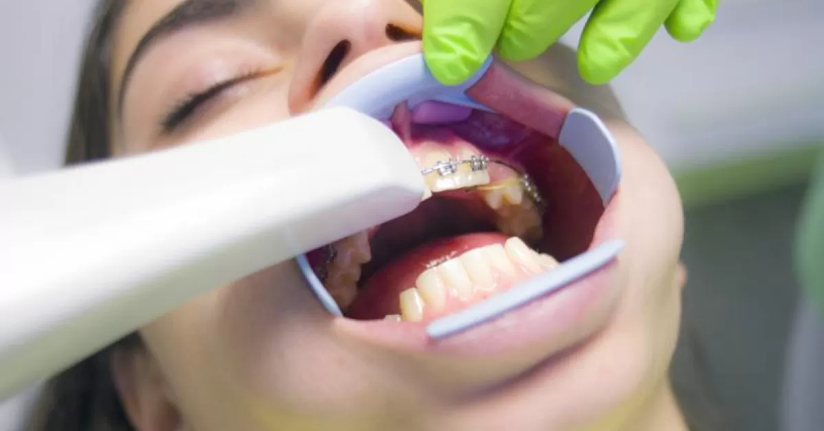 Cum-iti-dai-seama-ca-piticul-are-nevoie-de-aparat-dentar.jpg
